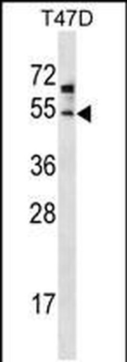 ZDHHC6 Rabbit anti-Human, Mouse, Polyclonal, Invitrogen 400 &mu;L; Unconjugated:Antibodies,