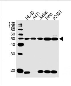 KRT28 Rabbit anti-Human, Polyclonal, Invitrogen 400 &mu;L; Unconjugated:Antibodies,