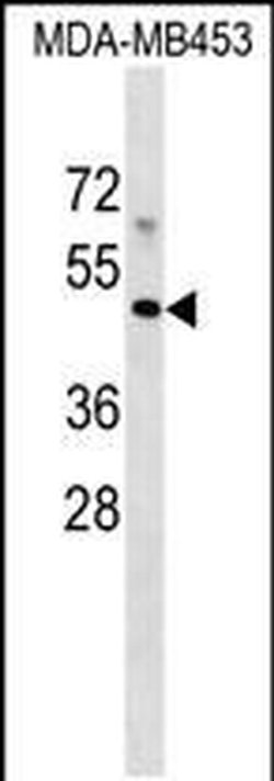 MR1 Rabbit anti-Human, Polyclonal, Invitrogen 400 &mu;L; Unconjugated:Antibodies,