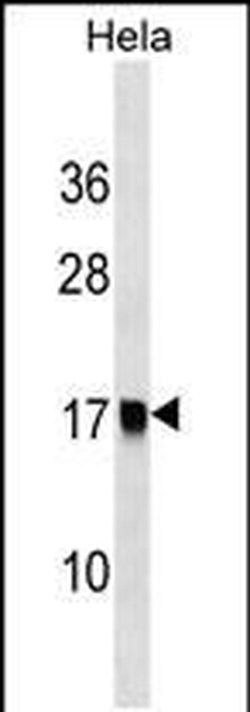 AP2S1 Rabbit anti-Human, Polyclonal, Invitrogen 400 &mu;L; Unconjugated:Antibodies,