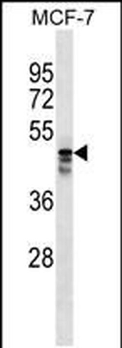 AP5M1 Rabbit anti-Human, Polyclonal, Invitrogen 400 &mu;L; Unconjugated:Antibodies,