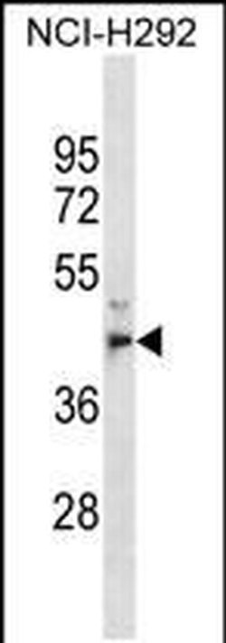 MPPE1 Rabbit anti-Human, Polyclonal, Invitrogen 400 &mu;L; Unconjugated:Antibodies,
