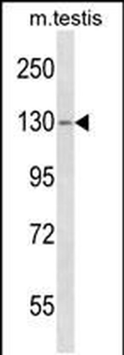 TBC1D2 Rabbit anti-Human, Mouse, Polyclonal, Invitrogen 400 &mu;L; Unconjugated:Antibodies,
