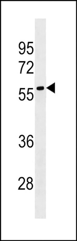 LRRC69 Rabbit anti-Human, Polyclonal, Invitrogen 400 &mu;L; Unconjugated:Antibodies,