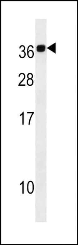 CABP2 Rabbit anti-Human, Polyclonal, Invitrogen 400 &mu;L; Unconjugated:Antibodies,