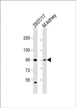 LRRC8A Polyclonal Antibody, Invitrogen 400 &mu;L; Unconjugated:Antibodies,