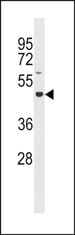 GLT8D4 Rabbit anti-Human, Polyclonal, Invitrogen 400 &mu;L; Unconjugated:Antibodies,