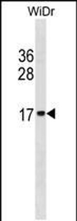 HIST2H2BE Rabbit anti-Human, Polyclonal, Invitrogen 400 &mu;L; Unconjugated:Antibodies,