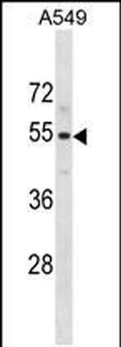 PUS10 Rabbit anti-Human, Polyclonal, Invitrogen 400 &mu;L; Unconjugated:Antibodies,