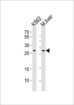 CYB5R2 Rabbit anti-Human, Mouse, Polyclonal, Invitrogen 400 &mu;L; Unconjugated:Antibodies,