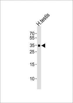 TEX101 Rabbit anti-Human, Polyclonal, Invitrogen 400 &mu;L; Unconjugated:Antibodies,