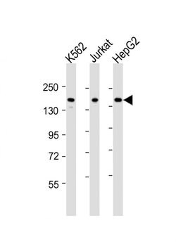 IQSEC2 Rabbit anti-Human, Polyclonal, Invitrogen 400 &mu;L; Unconjugated:Antibodies,