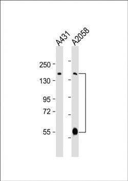 ADAMTS17 Rabbit anti-Human, Polyclonal, Invitrogen 80 &mu;L; Unconjugated:Antibodies,