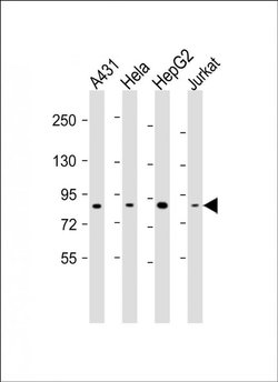 NEK10 Rabbit anti-Human, Polyclonal, Invitrogen 200 &mu;L; Unconjugated:Antibodies,