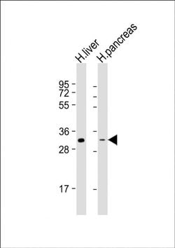 HSD17B8 Rabbit anti-Human, Polyclonal, Invitrogen 50 &mu;L; Unconjugated:Antibodies,