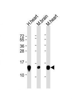 NDUFB3 Rabbit anti-Human, Mouse, Polyclonal, Invitrogen 200 &mu;L; Unconjugated:Antibodies,