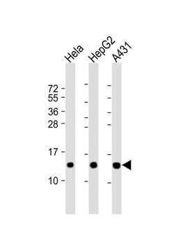 NDUFB3 Rabbit anti-Human, Mouse, Polyclonal, Invitrogen 200 &mu;L; Unconjugated:Antibodies,