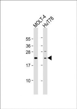DLEU7 Rabbit anti-Human, Polyclonal, Invitrogen 200 &mu;L; Unconjugated:Antibodies,