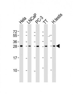 SSX1 Rabbit anti-Human, Polyclonal, Invitrogen 200 &mu;L; Unconjugated:Antibodies,