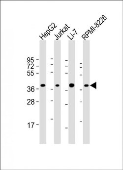 ARHGEF39 Rabbit anti-Human, Polyclonal, Invitrogen 200 &mu;L; Unconjugated:Antibodies,