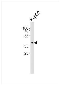 MRPS22 Rabbit anti-Human, Polyclonal, Invitrogen 100 &mu;L; Unconjugated:Antibodies,