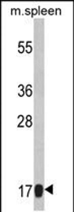RPS18 Rabbit anti-Human, Mouse, Polyclonal, Invitrogen 400 &mu;L; Unconjugated:Antibodies,