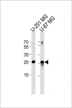VTI1A Rabbit anti-Human, Polyclonal, Invitrogen 400 &mu;L; Unconjugated:Antibodies,