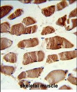 CSRP2BP Rabbit anti-Human, Mouse, Polyclonal, Invitrogen 400 &mu;L; Unconjugated:Antibodies,