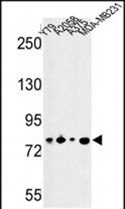 CSRP2BP Rabbit anti-Human, Mouse, Polyclonal, Invitrogen 400 &mu;L; Unconjugated:Antibodies,