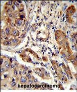 EBP Polyclonal Antibody, Invitrogen 400 &mu;L; Unconjugated:Antibodies,