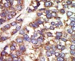 PAK2 Rabbit anti-Human, Polyclonal, Invitrogen 400 &mu;L; Unconjugated:Antibodies,