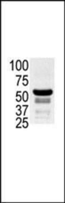 PAK2 Rabbit anti-Human, Polyclonal, Invitrogen 400 &mu;L; Unconjugated:Antibodies,