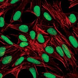 Invitrogen PARP1 Monoclonal Antibody (C.384.8) 100 &mu;L; Unconjugated:Antibodies,