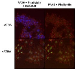 Invitrogen PAX6 Polyclonal Antibody 100 &mu;g; Unconjugated:Antibodies,