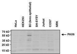Invitrogen PAX6 Monoclonal Antibody (13B10-1A10) 100 &mu;g; Unconjugated:Antibodies,