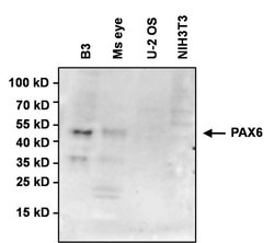 Invitrogen PAX6 Monoclonal Antibody (13B10-1A10) 100 &mu;g; Unconjugated:Antibodies,