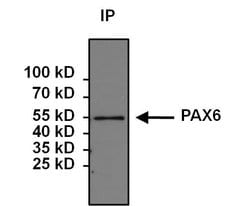 Invitrogen PAX6 Polyclonal Antibody 100 &mu;g; Unconjugated:Antibodies,
