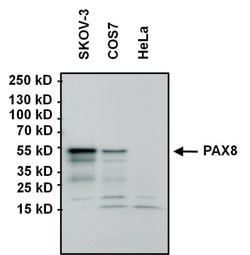 Invitrogen PAX8 Monoclonal Antibody (1F8-3A8) 100 &mu;g; Unconjugated:Antibodies,