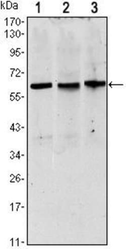 Invitrogen PAX8 Monoclonal Antibody (2D4) 100 &mu;L; Unconjugated:Antibodies,