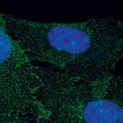 Invitrogen PDGFRB Monoclonal Antibody (G.290.3) 100 &mu;L; Unconjugated:Antibodies,