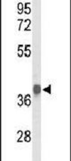 PDH Rabbit anti-Human, Polyclonal, Invitrogen 400 &mu;L; Unconjugated:Antibodies,