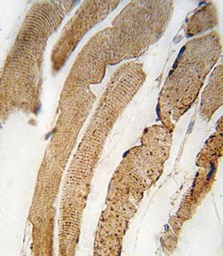 PDK4 Rabbit anti-Human, Polyclonal, Invitrogen 400 &mu;L; Unconjugated:Antibodies,