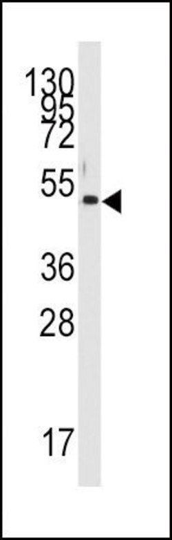 PDK4 Rabbit anti-Human, Polyclonal, Invitrogen 400 &mu;L; Unconjugated:Antibodies,