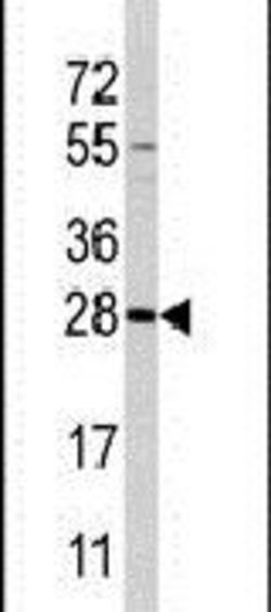 PEMT Rabbit anti-Human, Polyclonal, Invitrogen 400 &mu;L; Unconjugated:Antibodies,