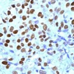 Progesterone Receptor, Polyclonal, Invitrogen 1 mL | Buy Online | Invitrogen | Fisher Scientific