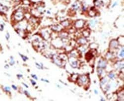 PIAS1 Rabbit anti-Human, Polyclonal, Invitrogen 400 &mu;L; Unconjugated:Antibodies,
