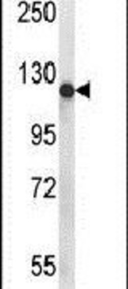 PIGN Rabbit anti-Human, Mouse, Polyclonal, Invitrogen 400 μL; Unconjugated:Antibodies,