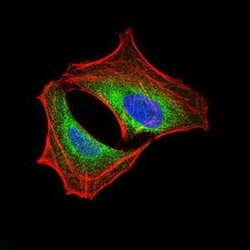 Invitrogen PI3K p85 alpha Monoclonal Antibody (6G10) 100 &mu;g; Unconjugated:Antibodies,