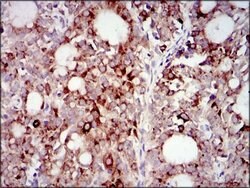 Invitrogen PI3K p85 alpha Monoclonal Antibody (6G10) 100 &mu;g; Unconjugated:Antibodies,