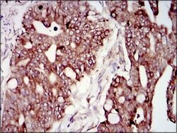 Invitrogen PI3K p85 alpha Monoclonal Antibody (6G10) 100 &mu;g; Unconjugated:Antibodies,